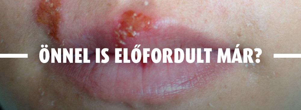 Éget, mar fáj a gyomra?